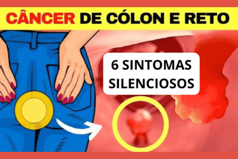 6 Sintomas Silenciosos do Câncer de Cólon e Reto: Detecte-os a Tempo!